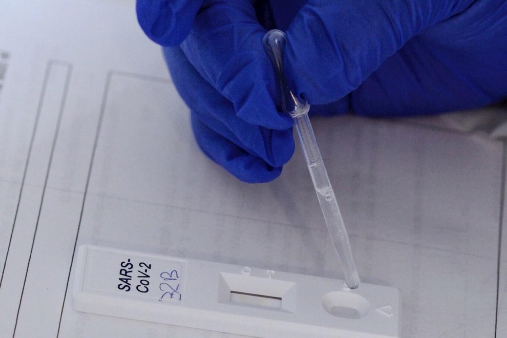 Realización de test rápido de PCR