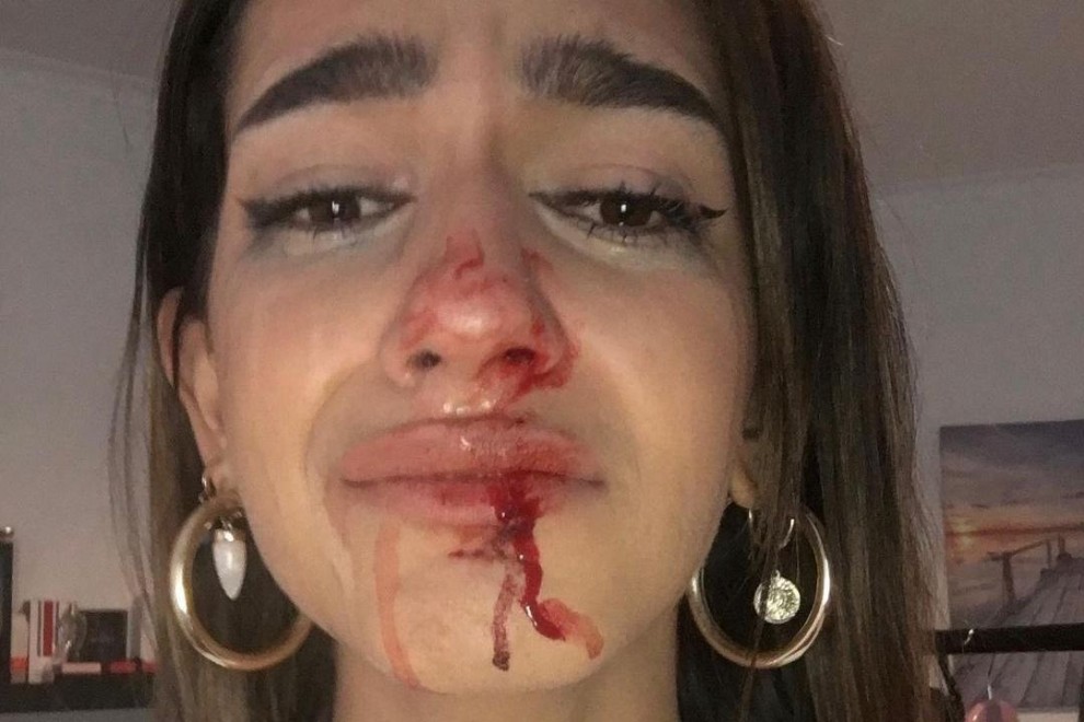 Eva muestra sus heridas tras la agresión tránsfoba. - Twitter de Eva