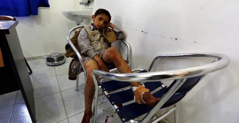 Un joven yemení que resultó herido en el ataque contra una mezquita chií en Saná (Yemen). EFE/YAHYA ARHAB