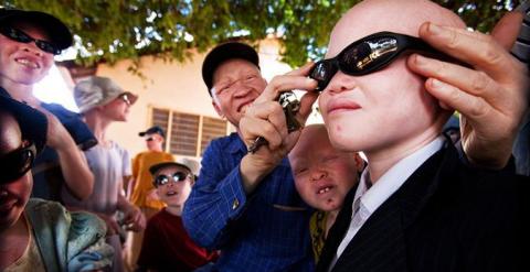 Los albinos en Tanzania disfrutan de las donaciones promovidas por Liron Shimoni./ Liron Shimoni