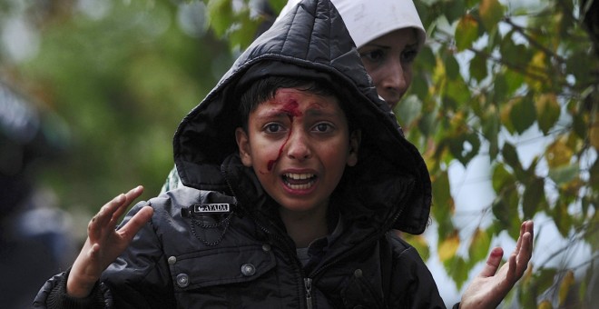 Un niño sirio herido en las cargas policiales contra los refugiados que tratan de cruzar la frontera entre Grecia y Macedonia.- REUTERS/Ognen Teofilovski