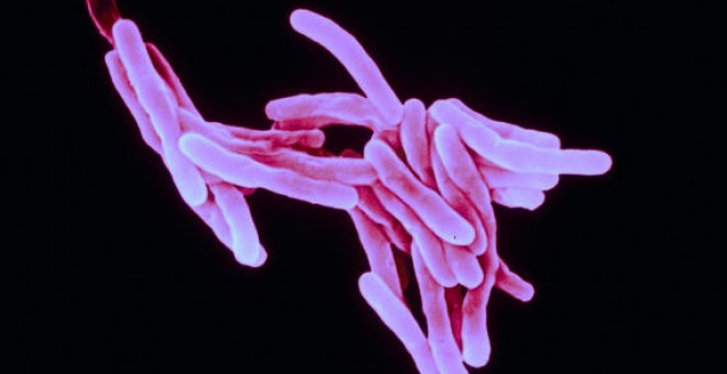 La tuberculosis está causada por la bacteria Mycobacterium tuberculosis, que destruye el tejido pulmonar. / Sanofi Pasteur