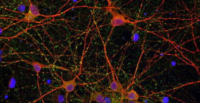 Imágenes de microscopía de cultivos de células neuronales. IBB-CSIC.