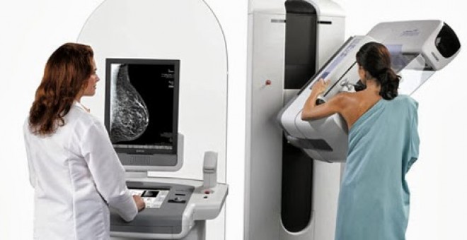 Educar en la autoexploración y mamografías más precisas son clave para prevenir el cáncer de mama