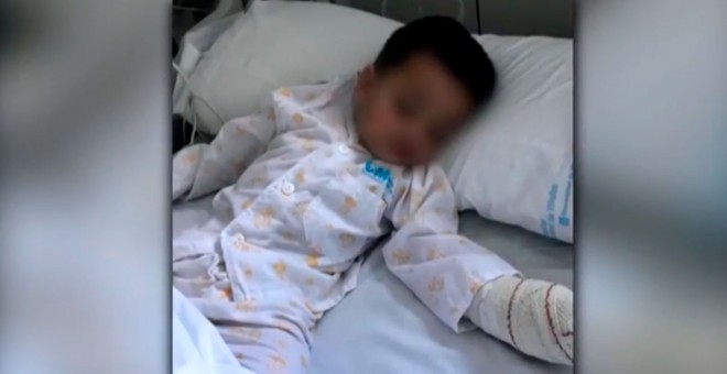 El niños atacado por el perro, en su cama del hospital.- CAPTURA