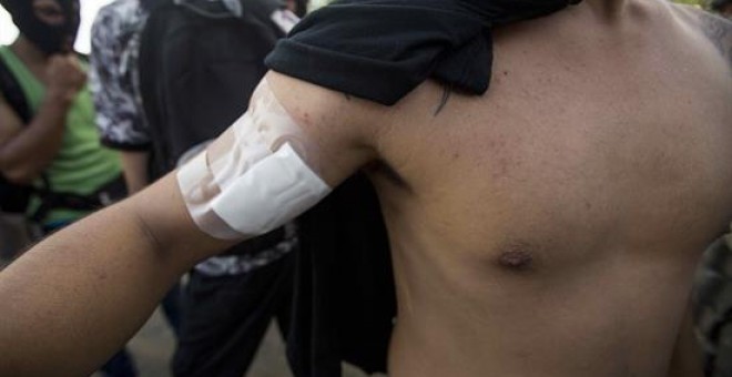 Un joven recibe un disparo de balines por personas desconocidas durante el día número 45 de protestas en contra del gobierno de Daniel Ortega. EFE Jorge Torres