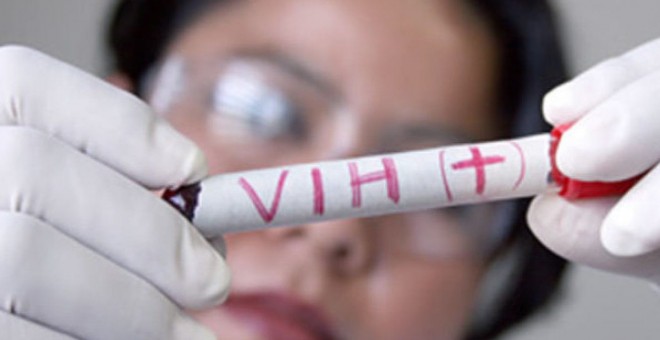 El hallazgo podría revolucionar el tratamiento del VIH. - EFE