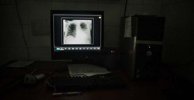 Un monitor donde se visualizan las radiografías en el Hospital Luis Razetti de Caracas, Venezuela.- JAIRO VARGAS