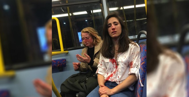 Una pareja de lesbianas fue agredida en un autobús en Londres por cuatro hombres. / FACEBOOK - MELANIA GEYMONAT