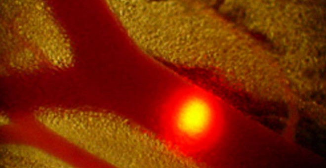 Célula cancerosa iluminada y destruida por un laser en una vena./UNIVERSITY OF ARKANSAS