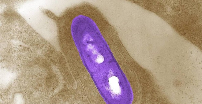 Imagen microscópica de una bacteria Listeria monocytogenes | Reuters