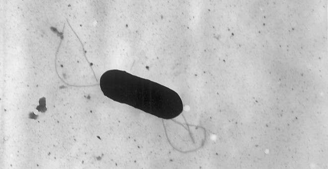 La bacteria de la listeria, a vista de microscopio.-CDC/ELIZABETH WHITE/WIKIMEDIA COMMONS