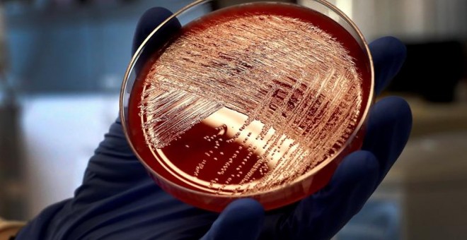 12/09/2019.- Vista de un cultivo de listeriosis en una placa de Petri, este jueves en el Laboratorio de Listeriosis del Centro Nacional de Microbiología de Madrid. Investigadores del Centro Nacional de Microbiología (CNM) han confirmado que una misma cepa