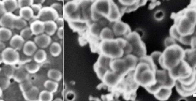 Células microbianas (izquierda) pueden ser fácilmente confundidas con precipitados minerales ricos en sílice (derecha). / Karim Benzerara, Puri López-García et al.