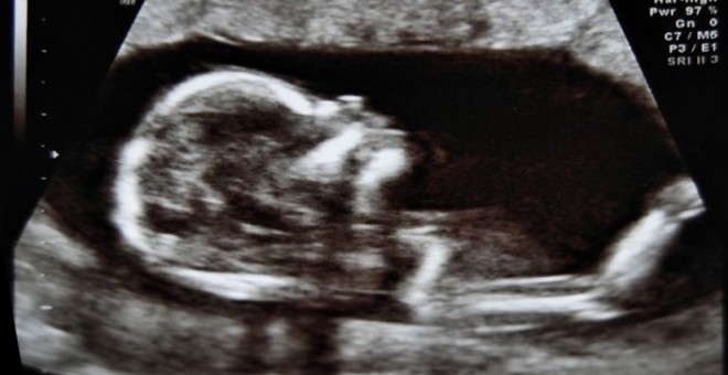 Una ecografía fetal en una imagen de archivo / Wikipedia Commons.