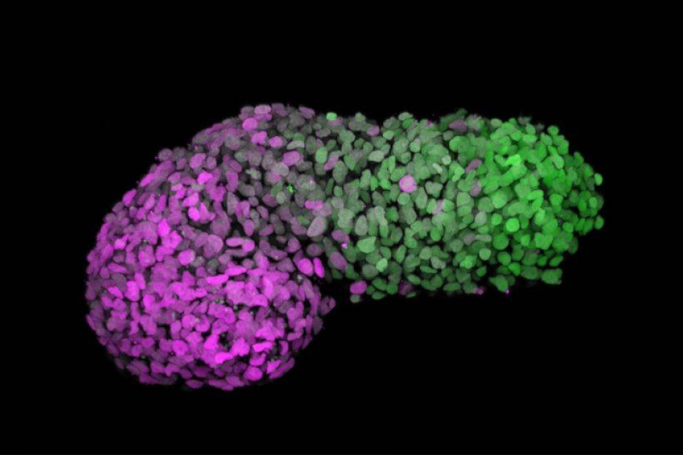 Gastruloide humano 72h después de la agregación. El verde marca la parte posterior, similar al extremo de la cola de un embrión (CDX2); y el magenta marca la parte anterior, similar a las células del corazón en desarrollo (GATA6). / SINC- Naomi Moris