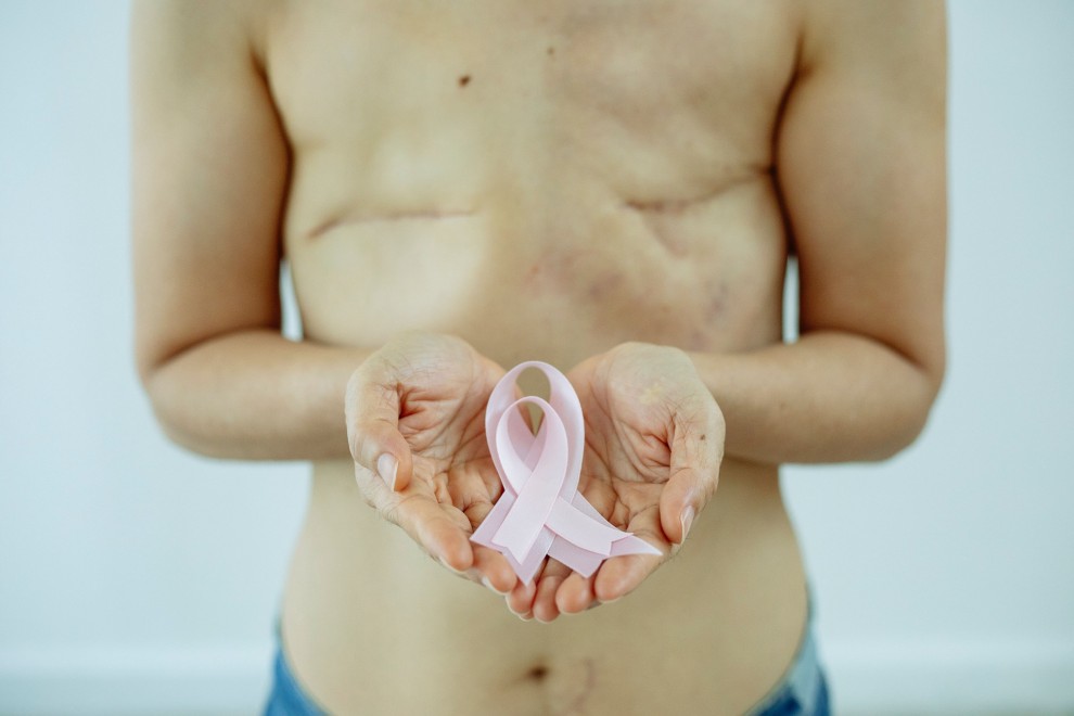 Imagen de archivo. Una mujer sostiene el lazo rosa, símbolo de la lucha contra el cáncer de mama.
