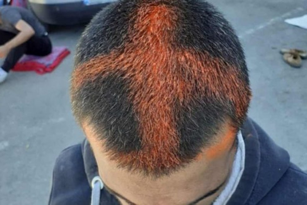 Un migrante interceptado por la policía croata, marcado con aerosol en la cabeza antes de ser devuelto en caliente a Bosnia en 2020.