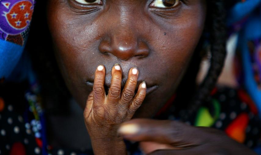 Los dedos de un niño desnutrido en Níger, por una de las peores sequías del país que arruinó gran parte de la cosecha (1 de agosto de 2005). REUTERS / Finbarr O'Reilly