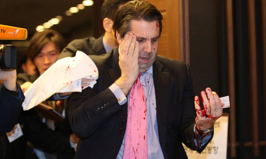 El embajador estadounidense en Corea, Mark Lippert, tras ser atacado por un agresor en el centro de Seúl. /YONHAP (REUTERS)