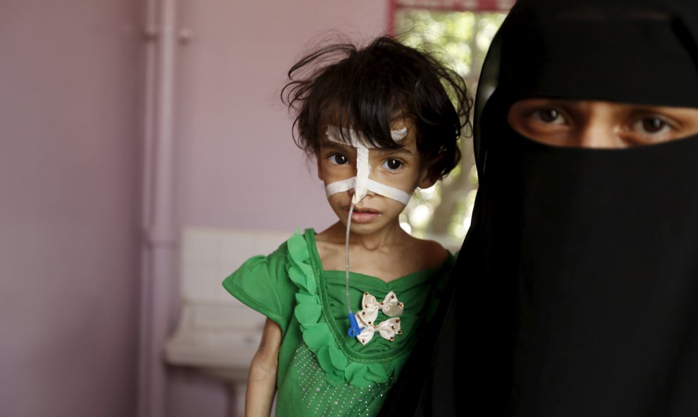 Una mujer coge en brazos a su hija desnutrida en un hospital en la capital de Yemen, Saná. La guerra en Yemen ha matado a más de 3.500 personas. UNICEF dice que la cifra de muertos incluye 365 niños. REUTERS / Khaled Abdullah