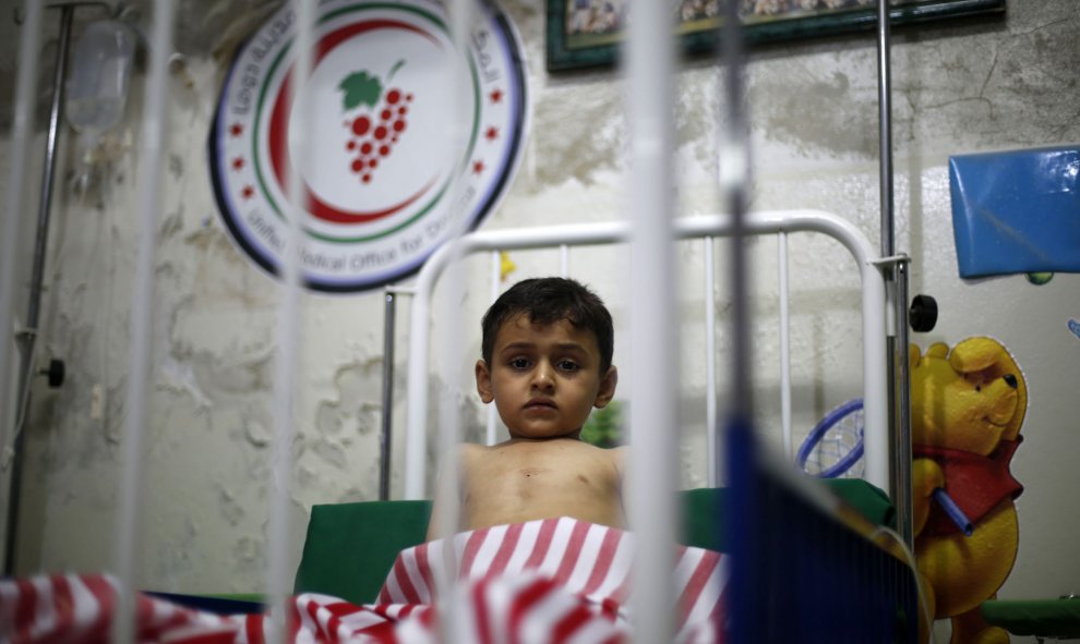 Obaida, un niño sirio de 4 años, se encuentra en una cama de hospital después de ser herido,tras los ataques aéreos de las fuerzas gubernamentales sirias en un mercado en la zona controlada por los rebeldes de Douma, al este de la capital Damasco el 17 de