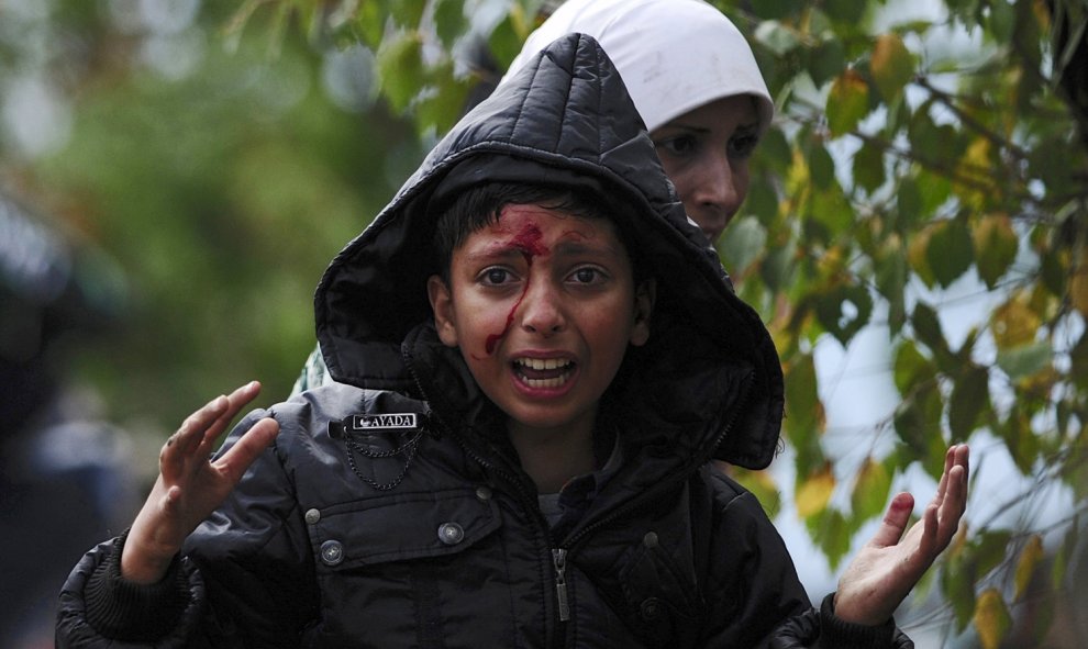 Un niño sirio herido en las cargas policiales contra los refugiados que tratan de cruzar la frontera entre Grecia y Macedonia.- REUTERS/Ognen Teofilovski