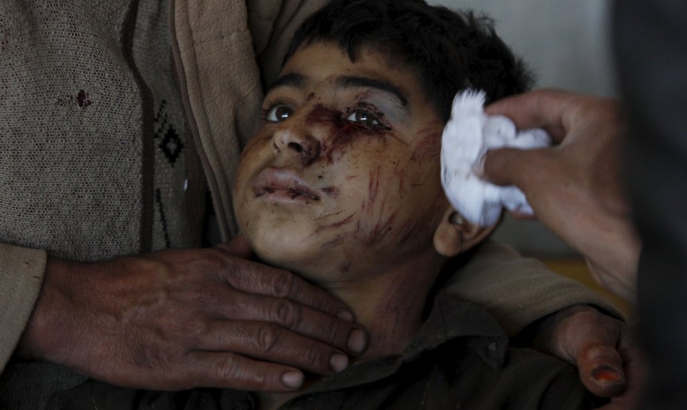 Un niño herido en el terremoto es atendido en el hospital Lady Reading en Peshawar, Pakistán./ REUTERS/Fayaz Aziz