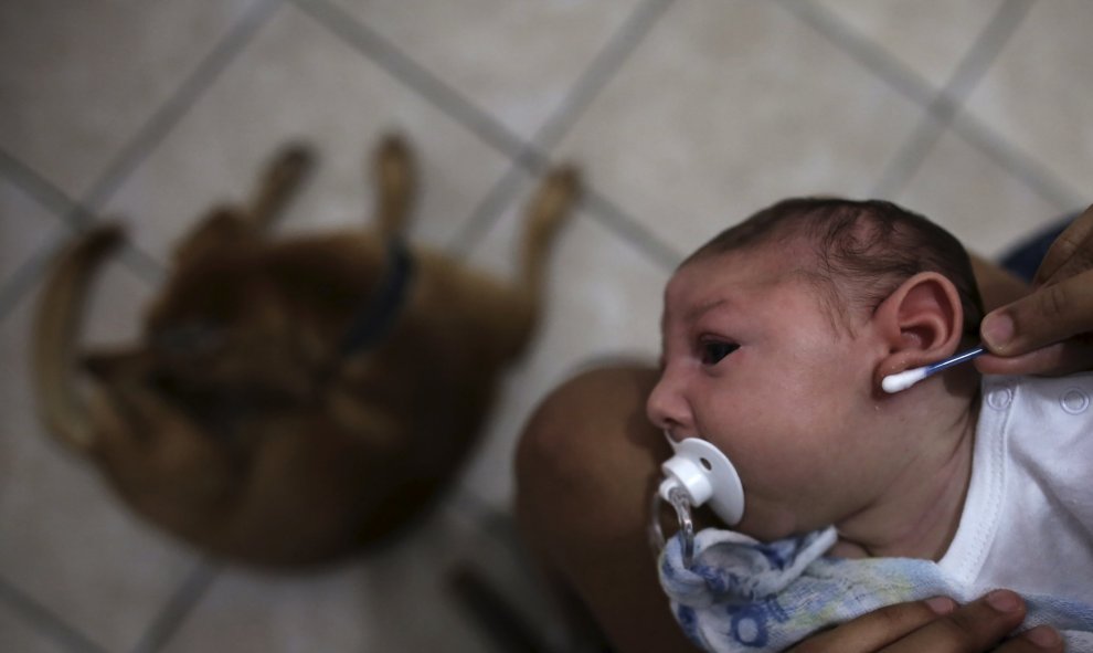 Daniele Santos, de 29 años, limpia el oído de su hijo Juan Pedro, que tiene 2 meses de edad y ha nacido con microcefalia, después de bañarlo en su casa en Recife, Brasil. El virus zika, transmitido por mosquitos, se ha generalizado en Brasil y se ha relac