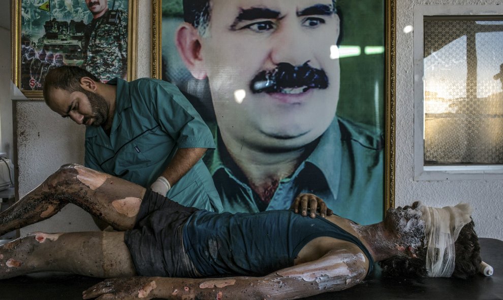Mejor foto de la sección de Noticias de actualidad: 'Un miembro del Estado Islámico es tratado en un hospital kurdo' de Mauricio Lima.