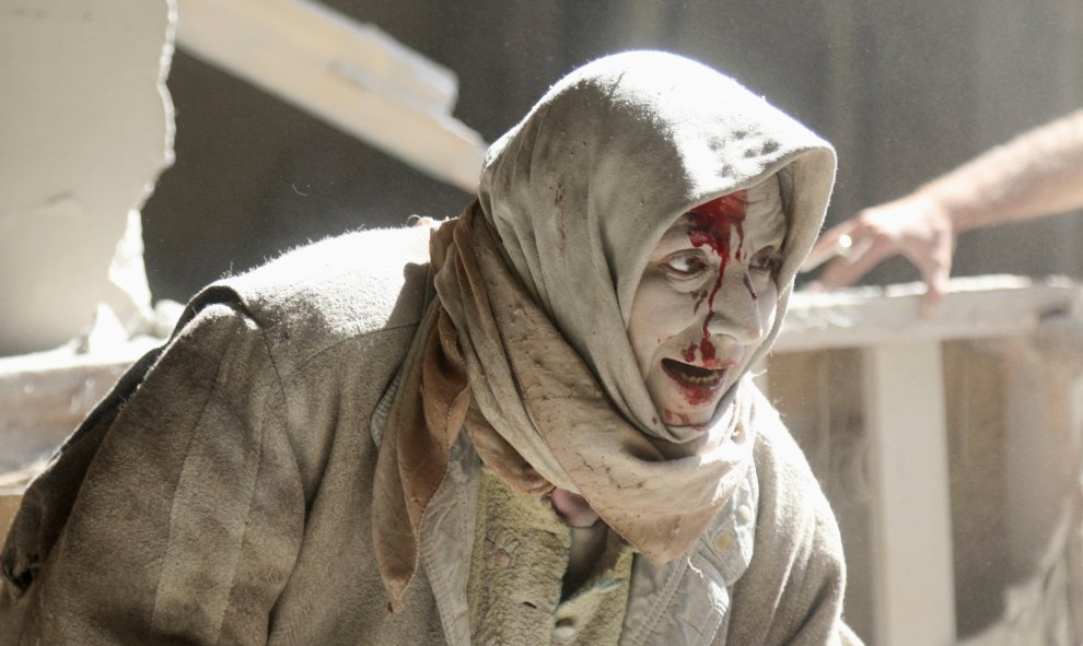 Una mujer herida en un lugar golpeado por ataques aéreos en las zonas rebeldes en el casco antiguo de Alepo. REUTERS/Abdalrhman Ismail