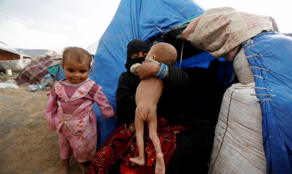 Una mujer sostiene a su bebé desnutrido, al lado de su casa: una tienda de campaña en un campamento para desplazados internos cerca de Sanaa, Yemen. REUTERS / Khaled Abdullah