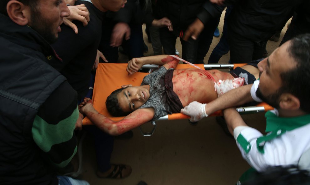 Un joven palestino es trasladado en una camilla después de haber sido herido durante una manifestación cerca de la frontera con Israel al este de Jabalia en la franja de Gaza.- Mohammed ABED / AFP