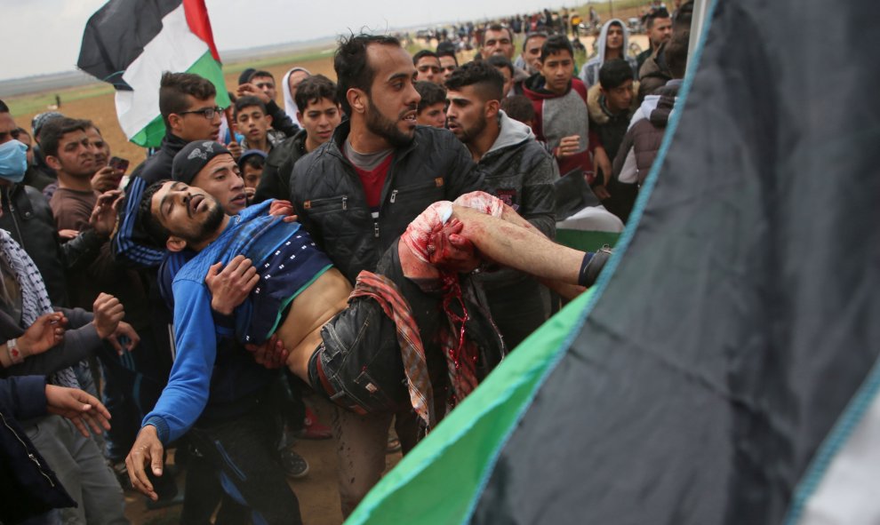 Un joven palestino es transportado en una camilla tras resultar herido durante una manifestación cerca de la frontera con Israel al este de Jabalia en la franja de Gaza que conmemora el Día de la Tierra.- Mohammed ABED / AFP