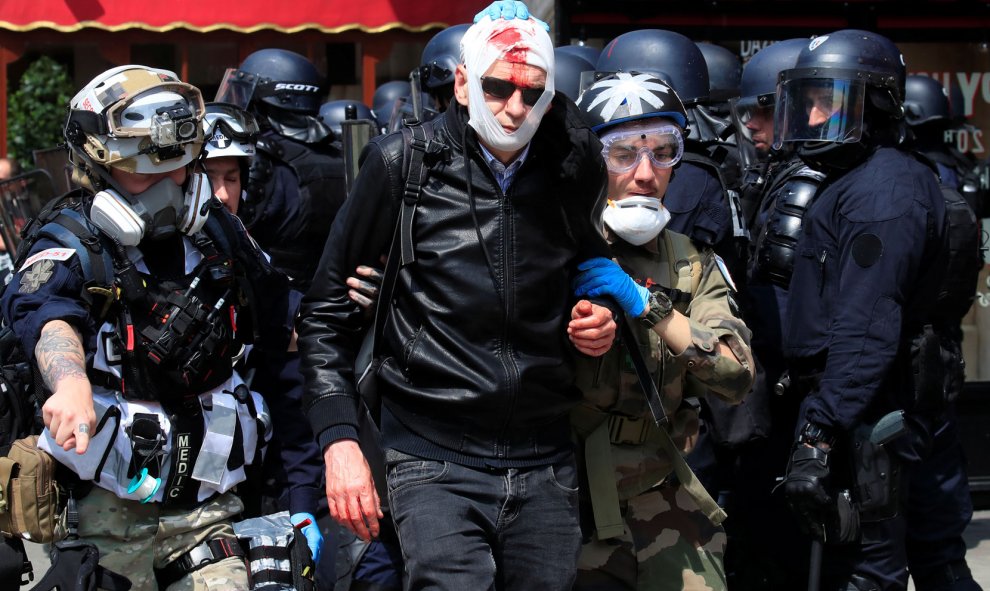 Un manifestante herido en la manifestación del Primero de Mayo en París. / GONZALO FUENTES (REUTERS)