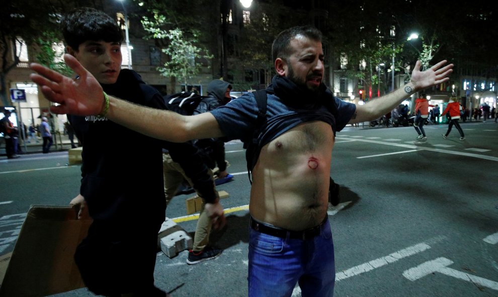 Un manifestante herido por los proyectiles disparados por los antidisturbios en Barcelona durante los enfrentamientos entre manifestantes y fuerzas policiales en Via Laietana.- REUTERS/ALBERT GEA