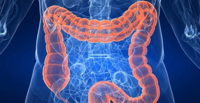 El cáncer de colon es de los más comunes en España, con 41.000 nuevos casos anuales