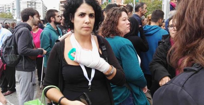 Marta Torrecillas, la mujer que denunció a la Policía por romperle los dedos de la mano durante el 1-O.