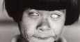 La "niña que vio la luz que brilla como mil soles" en Hiroshima, con la cara y los ojos quemados.