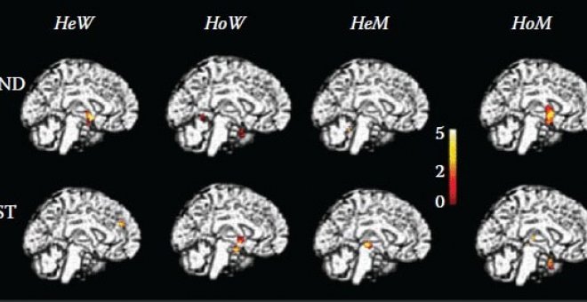 Actividad cerebral al oler AND y EST en heterosexuales femeninas, homosexuales femeninas, heterosexuales masculinas y homosexuales masculinos (de izquierda a derecha).- KAROLINSKA INSTITUTE