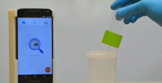 El analizador de semen para teléfonos inteligentes prueba la infertilidad masculina en menos de cinco segundos con una configuración impresa en 3D que cuesta unos 4 euros. /  Vignesh Natarajan