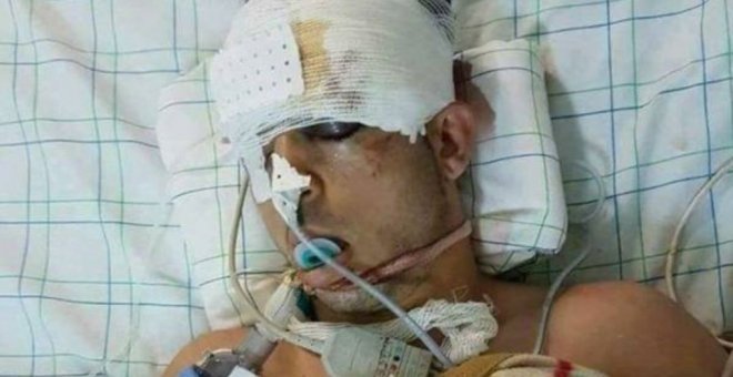 Imagen del joven fallecido durante su estancia en el hospital, difundida por varios medios marroquíes.