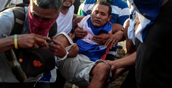 Uno de los heridos durante las protestas - REUTERS