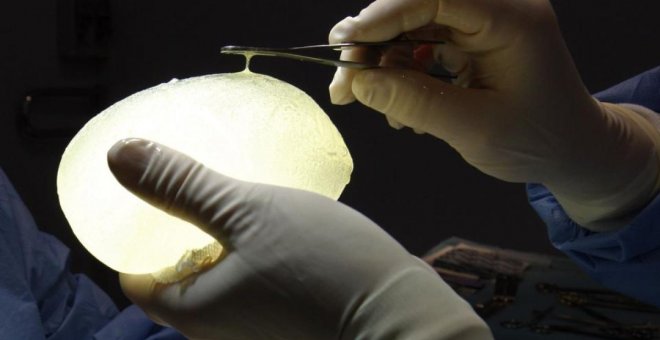 Un cirujano sujeta un implante de silicona PIP. Reuters