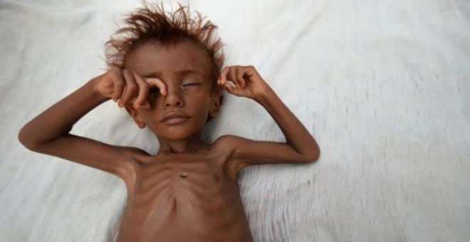 La mitad de la población de Yemen, a un paso de la hambruna