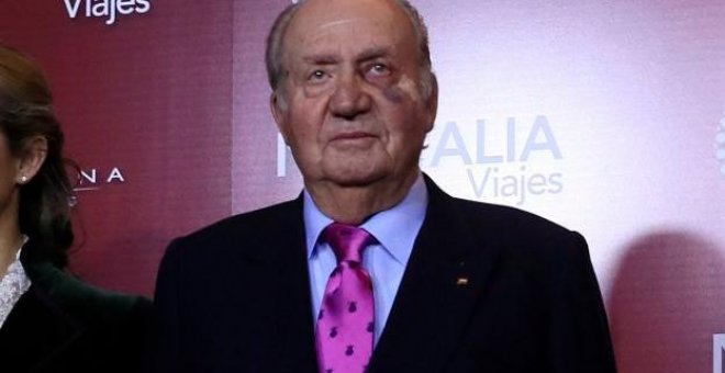 El rey emérito Juan Carlos, con un moratón y el apósito debajo del ojo | EFE