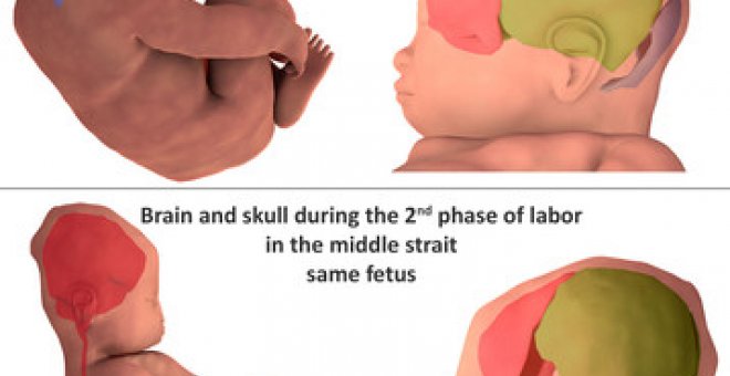 Reconstrucción tridimensional de los huesos craneales antes del parto y durante la segunda parte del mismo. / Ami et al