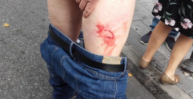 Imagen de uno de los heridos durante los incidentes en un desahucio en Alcorcón.- PAH ALCORCÓN