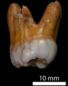 Molar de gran tamaño de un denisovano, analizado por el equipo de Svante Paabo. Bence Viola