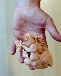 Dos corazones impresos a tamaño real en 3D para planificar su intervención en niños. EFE/Jorge Zapata